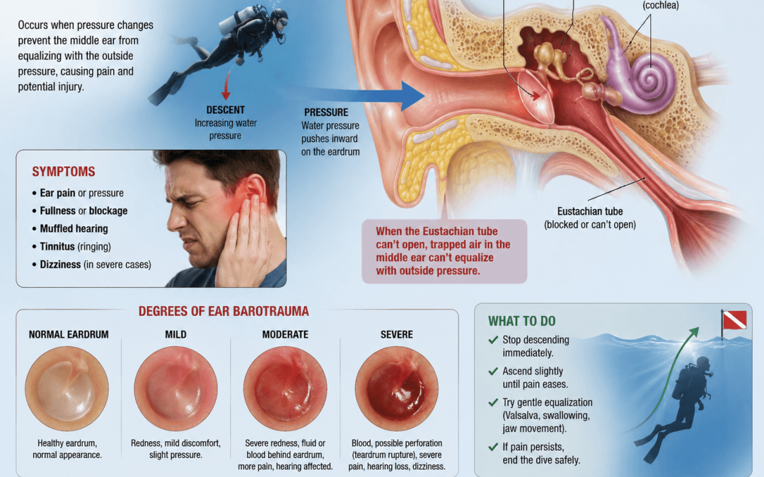 What Happen when ear hurt after dive